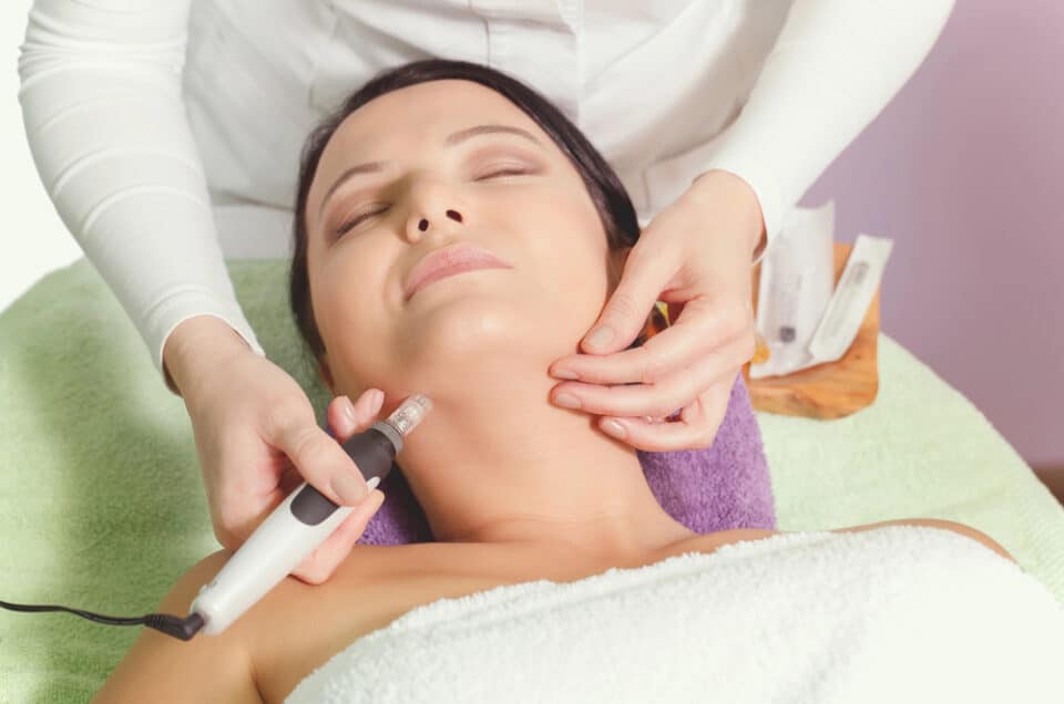 The Benefits Of Microneedling Transforming Your Skin At Pommier Med Spa