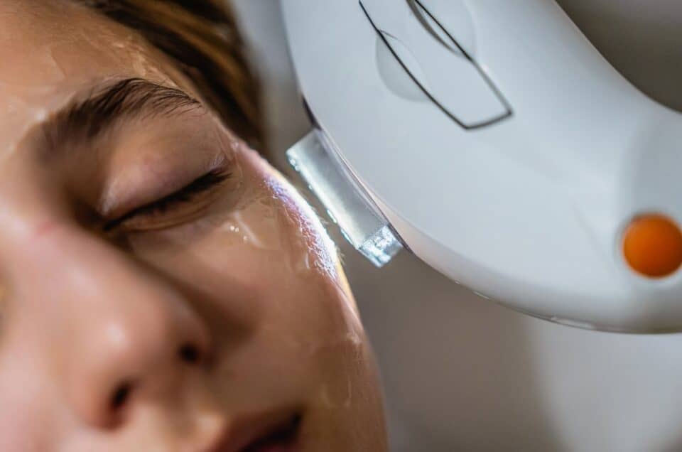 Hollywood Spectra Laser vs. IPL For Brown Spots And Melasma: Which Is Right For You?
