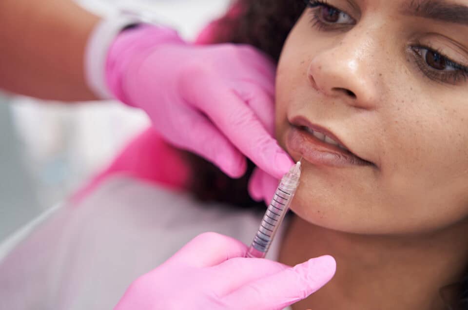Dermal Filler Trends for 2025: Embrace Subtle, Natural Beauty